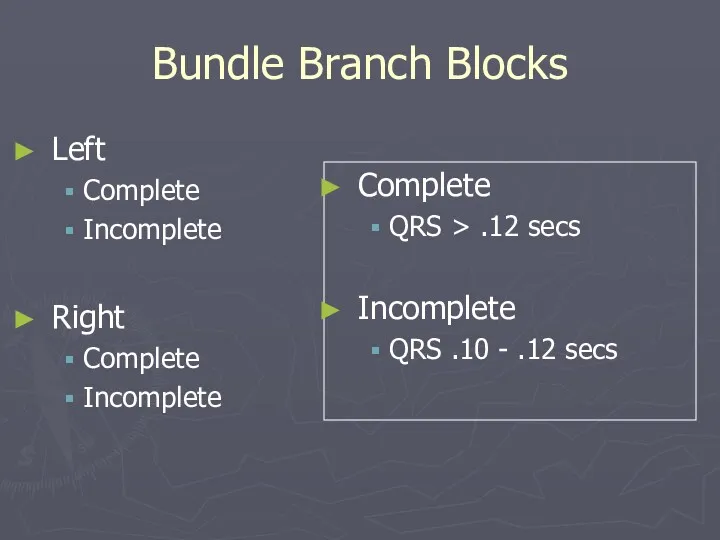 Bundle Branch Blocks Complete QRS > .12 secs Incomplete QRS