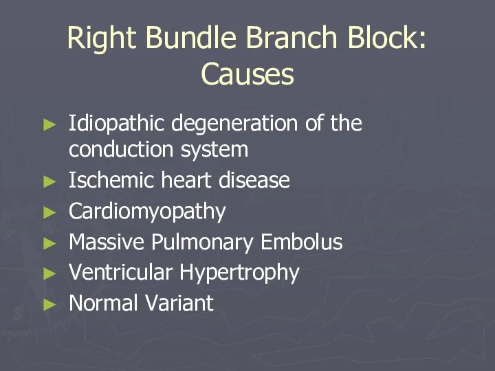 Right Bundle Branch Block: Causes Idiopathic degeneration of the conduction