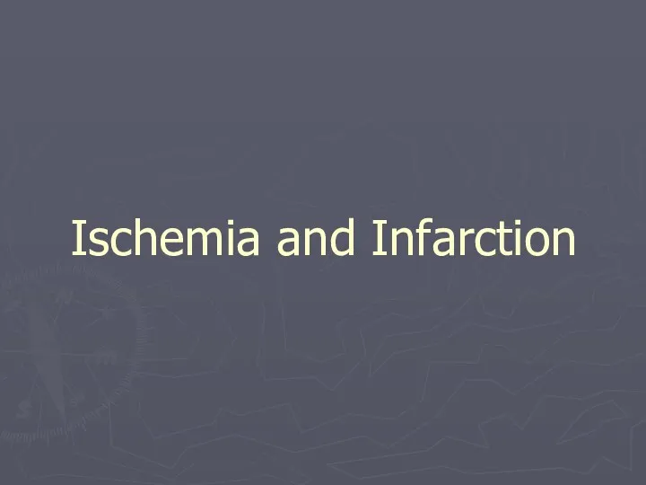 Ischemia and Infarction
