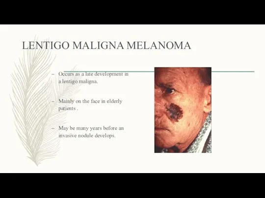 LENTIGO MALIGNA MELANOMA Occurs as a late development in a lentigo maligna. Mainly