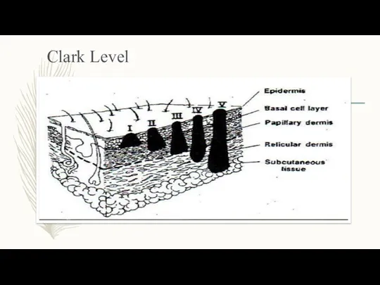 Clark Level