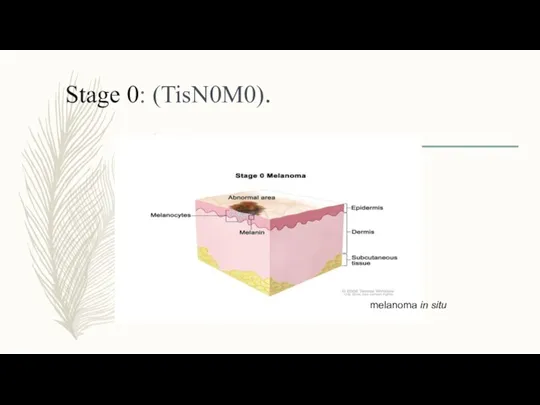 Stage 0: (TisN0M0). melanoma in situ