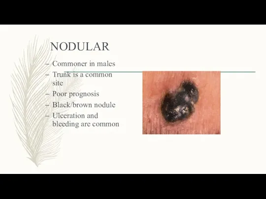 NODULAR Commoner in males Trunk is a common site Poor prognosis Black/brown nodule