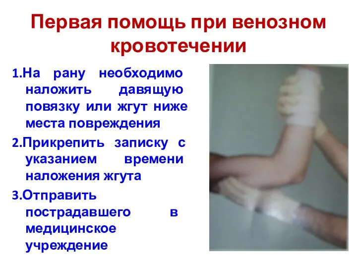 Первая помощь при венозном кровотечении 1.На рану необходимо наложить давящую повязку или жгут