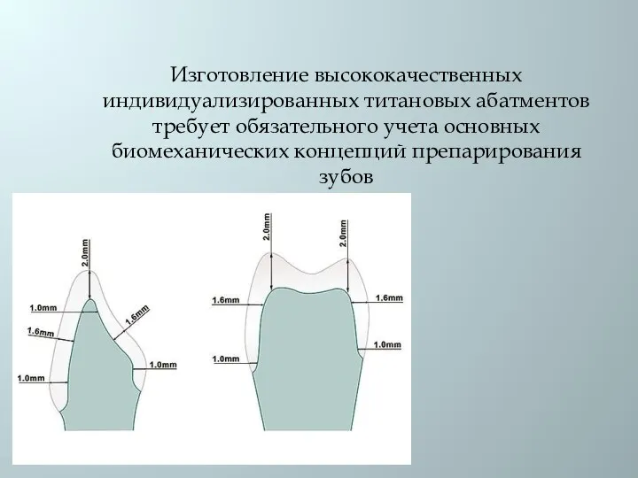 Изготовление высококачественных индивидуализированных титановых абатментов требует обязательного учета основных биомеханических концепций препарирования зубов