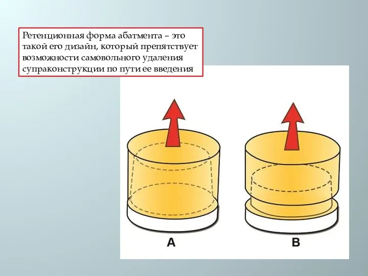 Ретенционная форма абатмента – это такой его дизайн, который препятствует