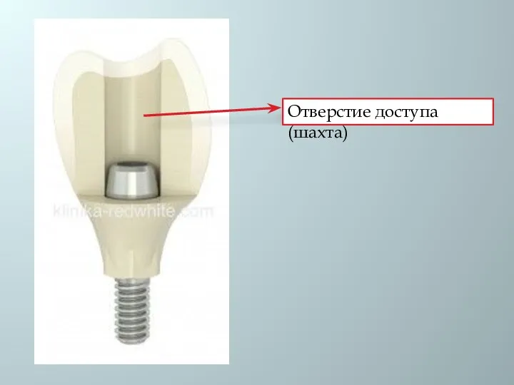 Отверстие доступа (шахта)