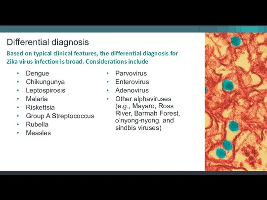 Differential diagnosis Dengue Chikungunya Leptospirosis Malaria Riskettsia Group A Streptococcus