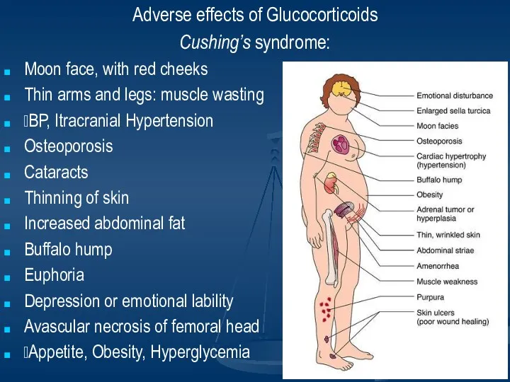 Adverse effects of Glucocorticoids Cushing’s syndrome: Moon face, with red