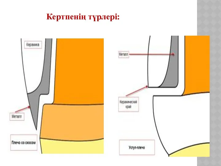 Кертпенің түрлері: