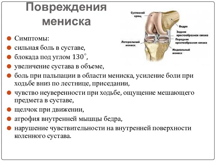 Повреждения мениска Симптомы: сильная боль в суставе, блокада под углом