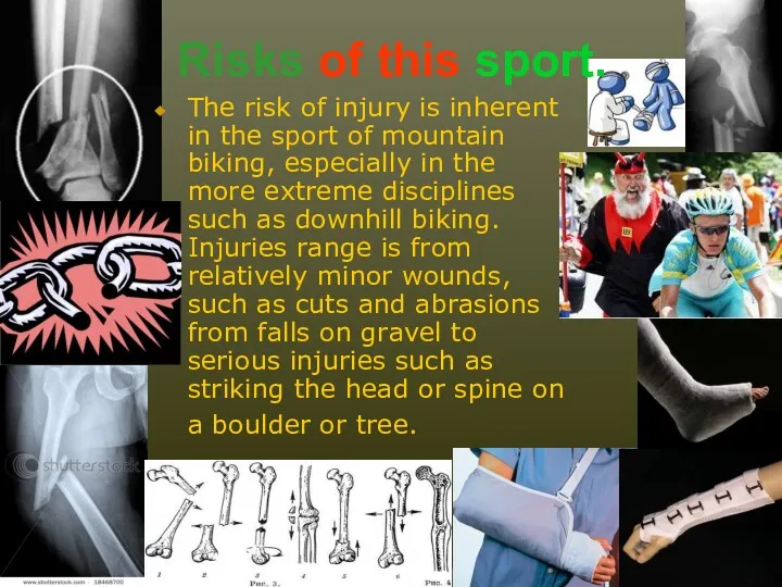 The risk of injury is inherent in the sport of