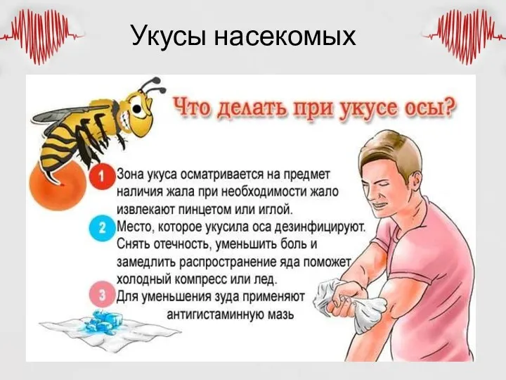 Укусы насекомых