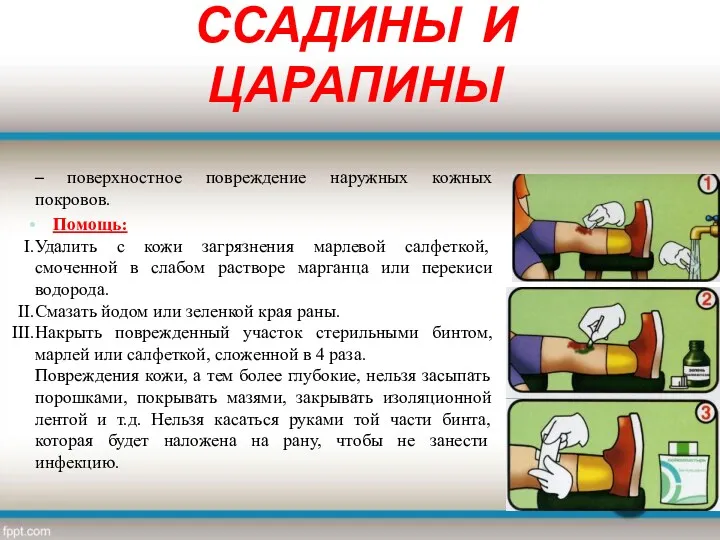 ССАДИНЫ И ЦАРАПИНЫ – поверхностное повреждение наружных кожных покровов. Помощь: