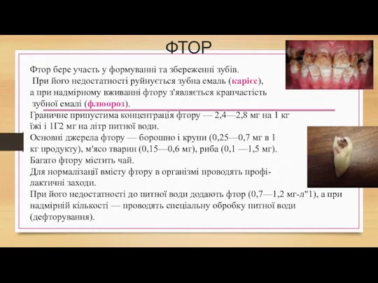 ФТОР Фтор бере участь у формуванні та збереженні зубів. При