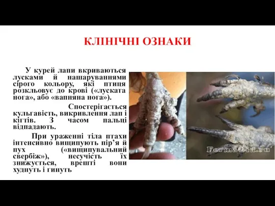 КЛІНІЧНІ ОЗНАКИ У курей лапи вкриваються лусками й нашаруваннями сірого кольору, які птиця