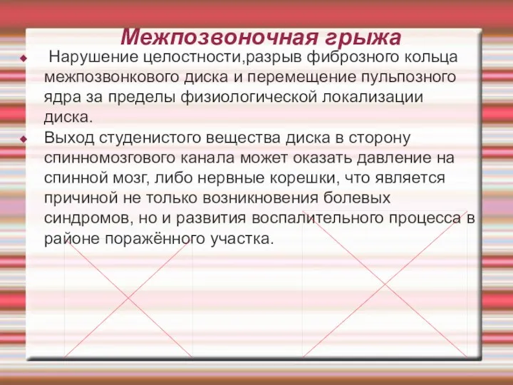 Межпозвоночная грыжа Нарушение целостности,разрыв фиброзного кольца межпозвонкового диска и перемещение