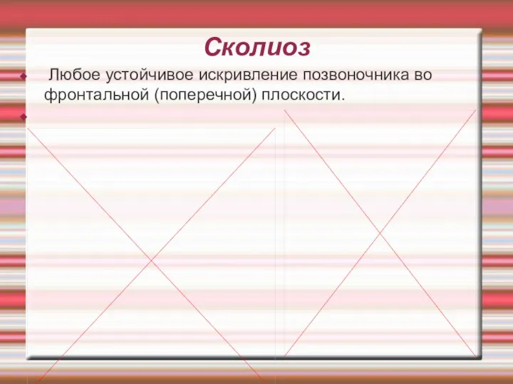 Сколиоз Любое устойчивое искривление позвоночника во фронтальной (поперечной) плоскости.