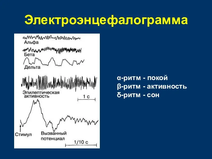 Электроэнцефалограмма α-ритм - покой β-ритм - активность δ-ритм - сон