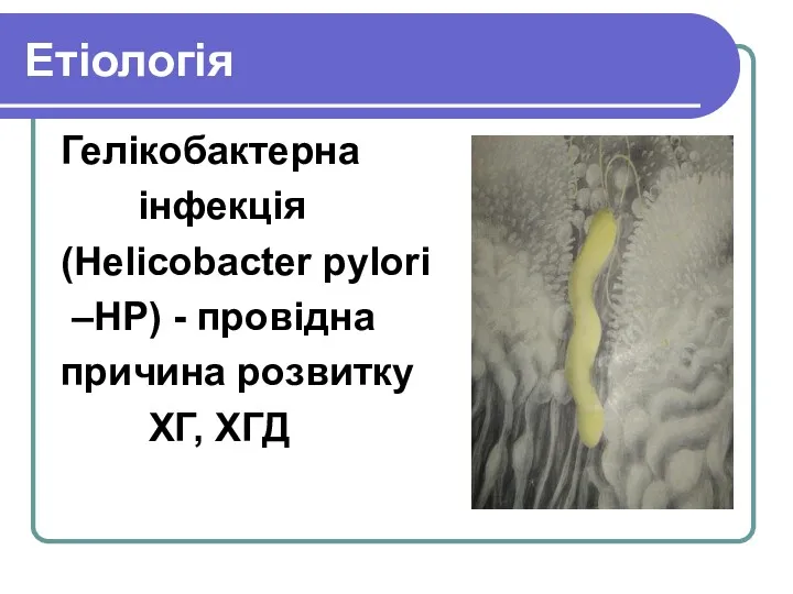 Етіологія Гелікобактерна інфекція (Helicobacter pylori –HP) - провідна причина розвитку ХГ, ХГД