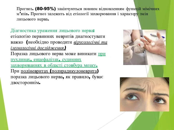 Прогноз. (80-95%) закінчуються повним відновленням функцій мімічних м'язів. Прогноз залежить