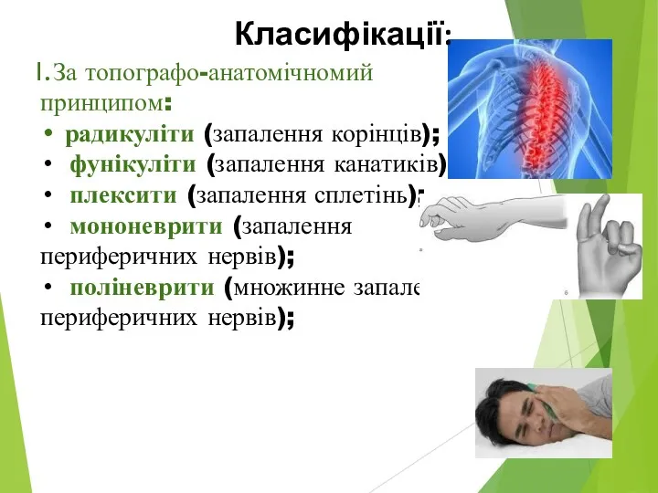 За топографо-анатомічномий принципом: радикуліти (запалення корінців); фунікуліти (запалення канатиків); плексити