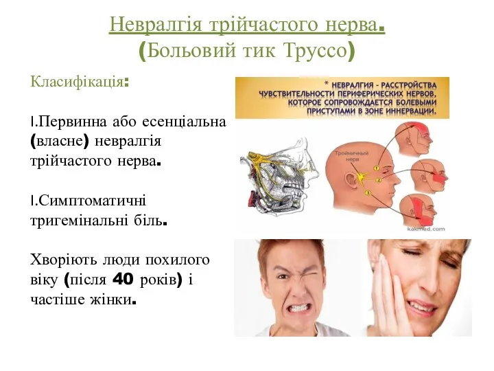 Невралгія трійчастого нерва. (Больовий тик Труссо) Класифікація: Первинна або есенціальна