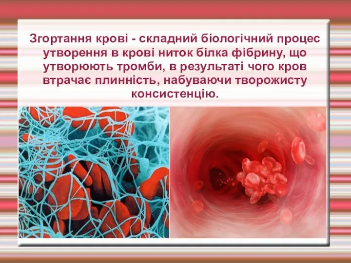 Згортання крові - складний біологічний процес утворення в крові ниток