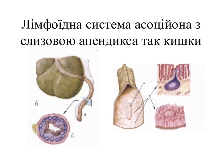 Лімфоїдна система асоційона з слизовою апендикса так кишки