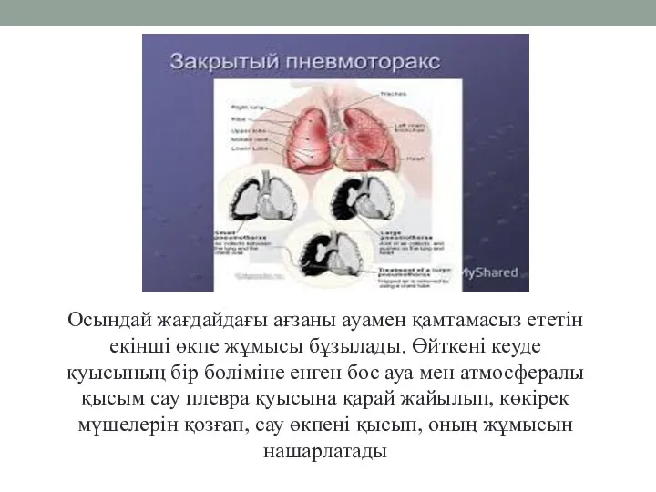 Осындай жағдайдағы ағзаны ауамен қамтамасыз ететін екінші өкпе жұмысы бұзылады.