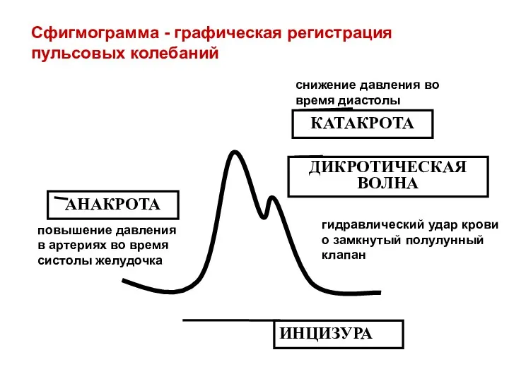 Сфигмограмма - графическая регистрация пульсовых колебаний АНАКРОТА КАТАКРОТА ДИКРОТИЧЕСКАЯ ВОЛНА