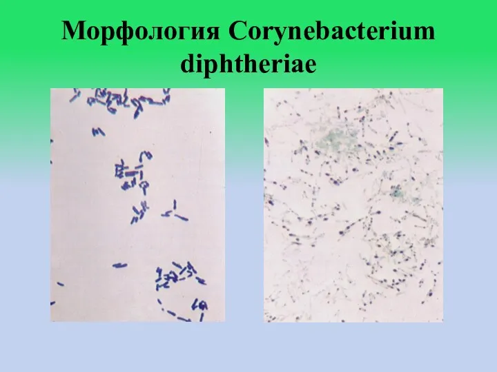 Морфология Corynebacterium diphtheriae