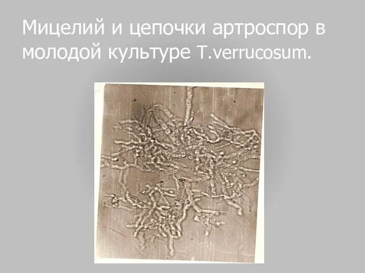 Мицелий и цепочки артроспор в молодой культуре T.verrucosum.