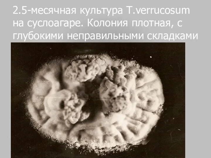 2.5-месячная культура T.verrucosum на суслоагаре. Колония плотная, с глубокими неправильными складками