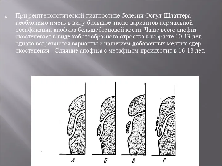 При рентгенологической диагностике болезни Осгуд-Шлаттера необходимо иметь в виду большое