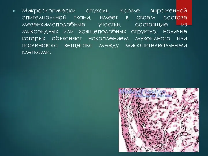 Микроскопически опухоль, кроме выраженной эпителиальной ткани, имеет в своем составе