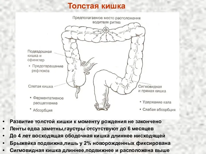 Толстая кишка Развитие толстой кишки к моменту рождения не закончено