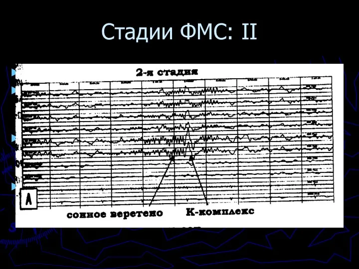 Стадии ФМС: II Стадия II = поверхностный сон Характеризуется появлением