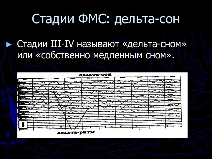 Стадии ФМС: дельта-сон Стадии III-IV называют «дельта-сном» или «собственно медленным сном».