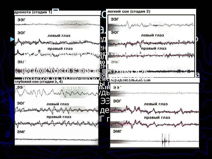 Парадоксальность “парадоксального” сна Для смены стадий медленного сна характерно постепенное
