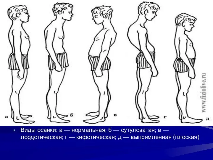 Виды осанки: а — нормальная; б — сутуловатая; в —