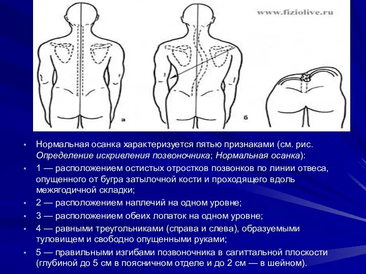 Нормальная осанка характеризуется пятью признаками (см. рис. Определение искривления позвоночника;