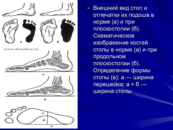 Внешний вид стоп и отпечатки их подошв в норме (а)