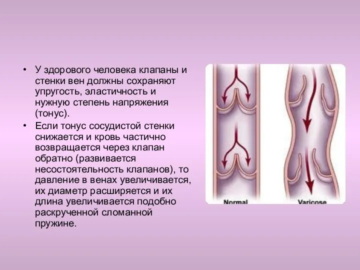 У здорового человека клапаны и стенки вен должны сохраняют упругость,