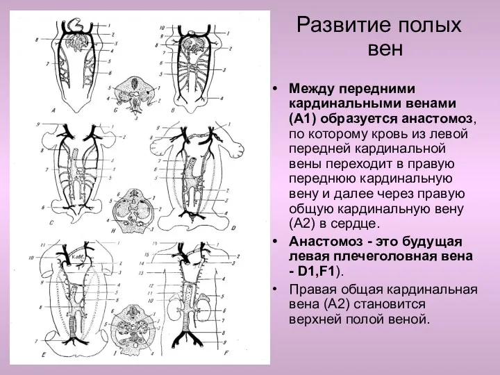 Развитие полых вен Между передними кардинальными венами (A1) образуется анастомоз,