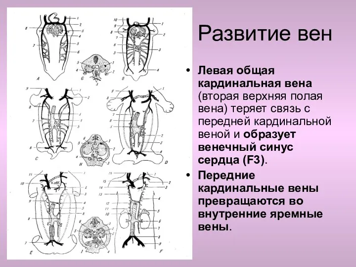 Развитие вен Левая общая кардинальная вена (вторая верхняя полая вена)