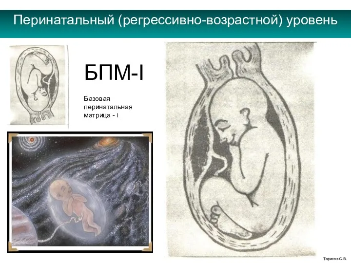 Перинатальный (регрессивно-возрастной) уровень Тарасов С.В. БПМ-I Базовая перинатальная матрица - I