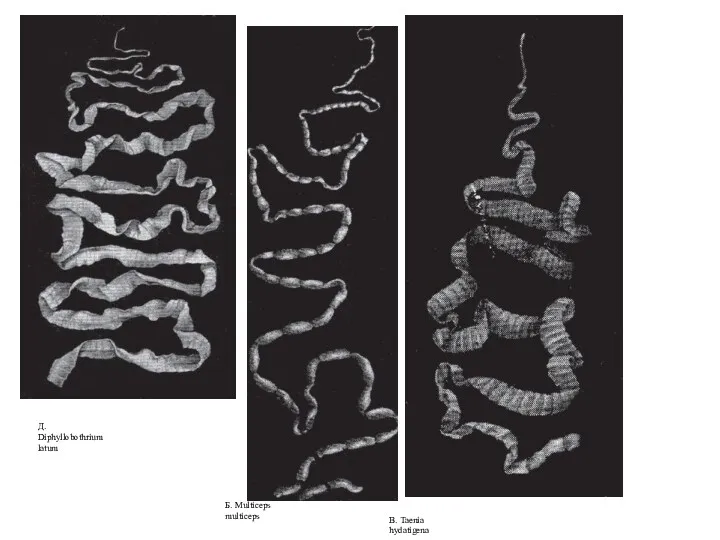 Д. Diphyllobothrium latum Б. Multiceps multiceps В. Taenia hydatigena