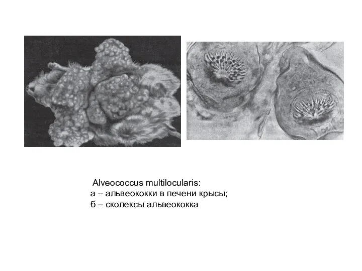 Alveococcus multilocularis: а – альвеококки в печени крысы; б – сколексы альвеококка