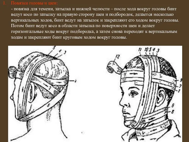 Повязки головы и шеи: - повязка для темени, затылка и